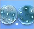 検査したすべての抗生物質が効かない例