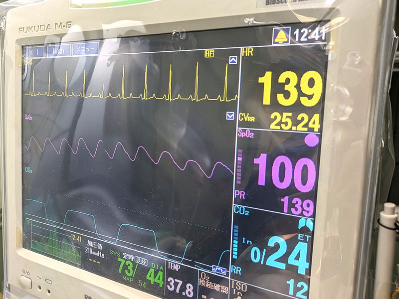 手術用モニター